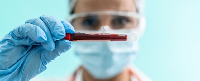 A person wearing a mask holding blood in a tube