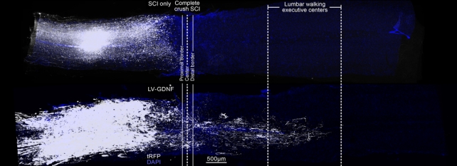 Regenerating axons across the site of complete spinal cord injury