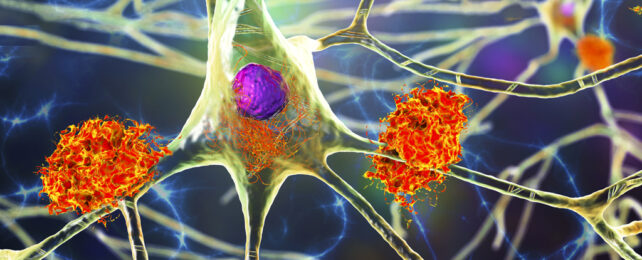 illustration of yellow neurons surrounded by red placques