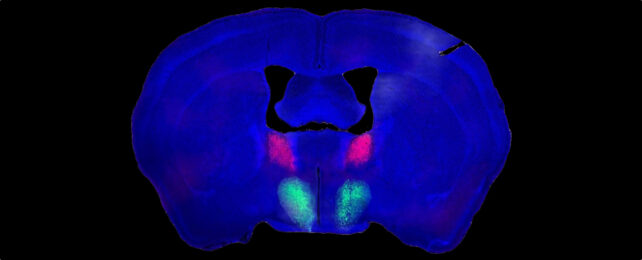 Mouse Brain Scan