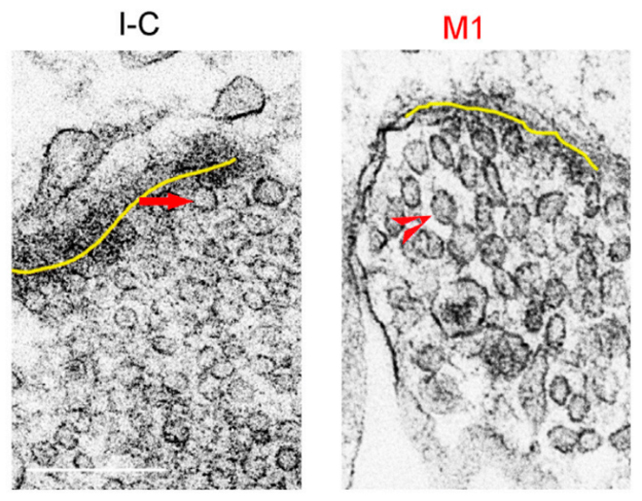 Neuron scans