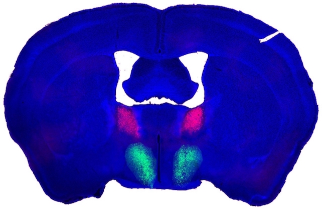 image of a male mouse's brain, color-coded to show different areas