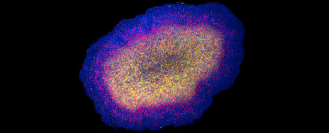 close up of blobby cell with different part colored brightly showing the expression of different molecules