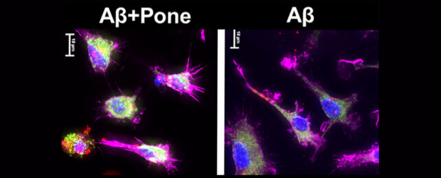 fluorescent microglial cells absorbing protein clumps