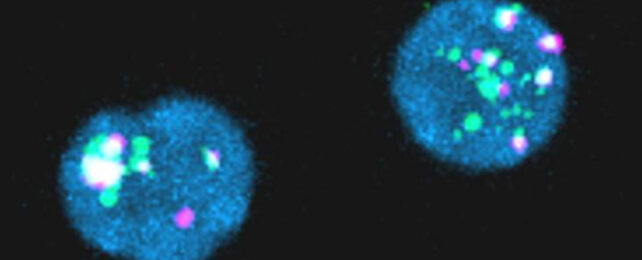 'Deceptive' HIV Doesn't Become as Dormant as We Thought