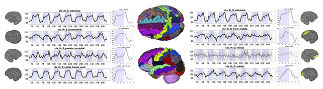 Brain scans