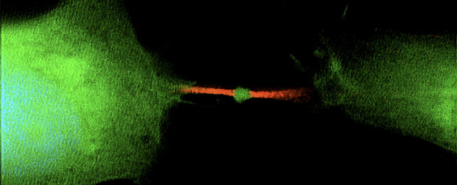 Two green-colour cells joined by a thin, red-coloured strand.