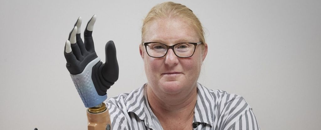 Rewolucyjna elektroniczna dłoń, która łączy się z kobiecymi kośćmi, mięśniami i nerwami: ScienceAlert