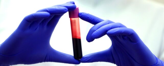 Lab Gloves Hold Blood Vial