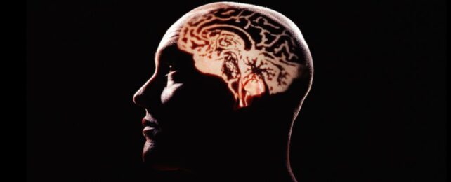 'Grave Consequences': Scientists Warn of Extreme Bias in Brain Aging Research