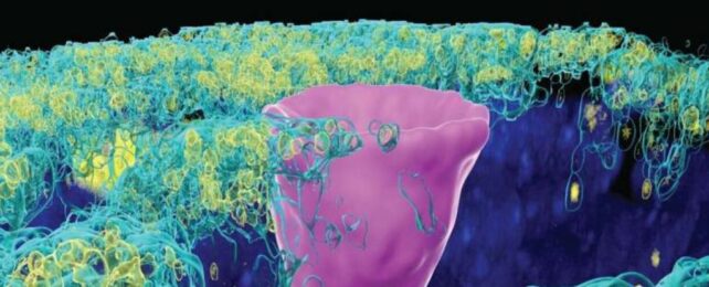 Unexpected 'Fish' Cell Found in Human Lungs Could Be Key to Cystic Fibrosis
