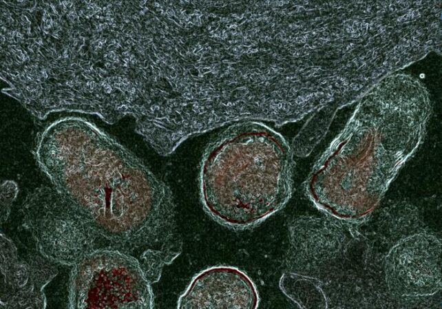 Oval-shaped bacteria attached to tissue, stained with fluorescent markers and viewed under microscope.