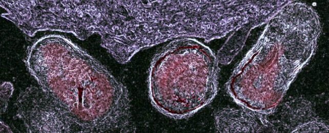 Microscope image of oval-shaped bacteria cells attacking cell surface of the vagina.