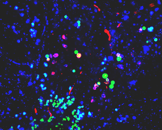 Microscope analysis