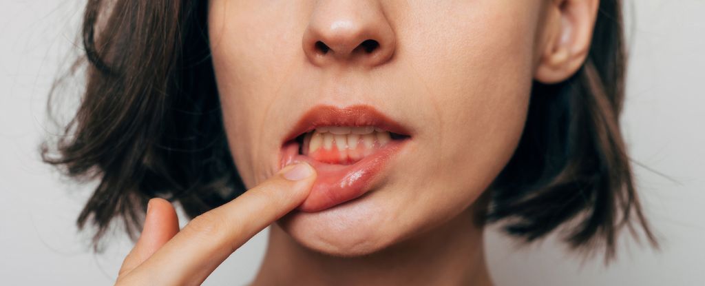 Poor Oral Hygiene Could Be Taking a Toll on Your Heart, Expert Says