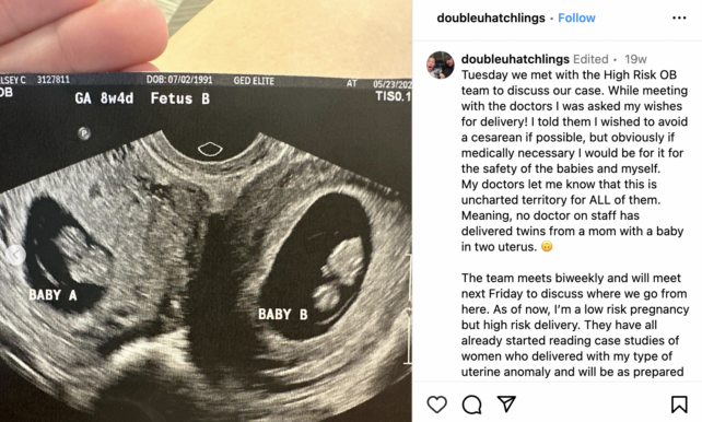Screenshot ultrasound on Instagram