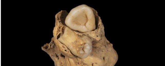Scientists Find a Tumor Made of Teeth in The Pelvis of an Ancient Egyptian