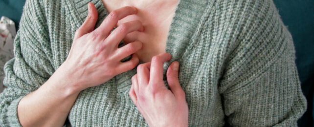 Close up of person in green knitted jumping scratching irritated skin on chest.