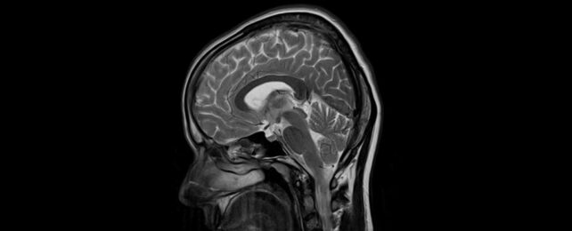 brain xray scan