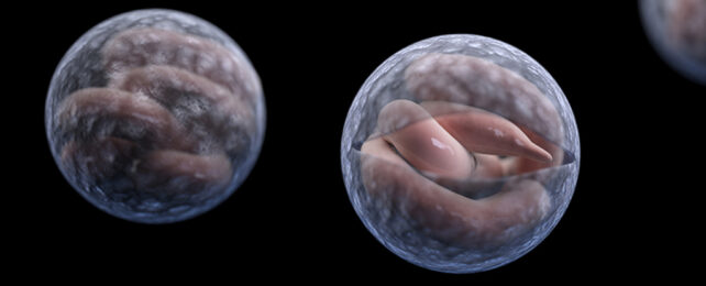 Severe Diarrhea Cases Surging Across UK, And Scientists Don't Know Why
