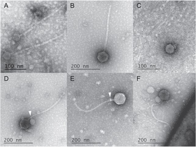transmitting electron micrograph images of viruses