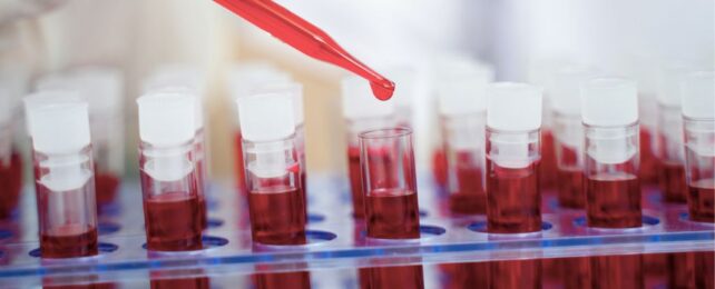 People With Suicidal Thoughts Show a Chemical Pattern in Their Blood