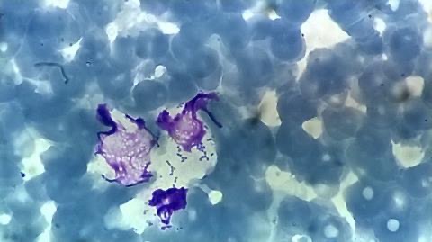 Microscope image of blood cells, stained blue, and bacterial cell, stained purple.