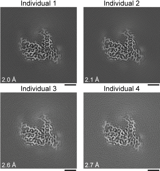 Panel of four black and white images showing proteins with exact same shape.