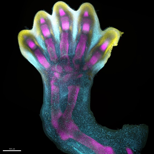 Microscopy image of human embryonic tissue forming hand with five digits. Tissue is stained blue, pink and yellow.