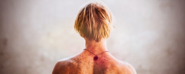 Freckled Back Of Shirtless Man With Blond Hair