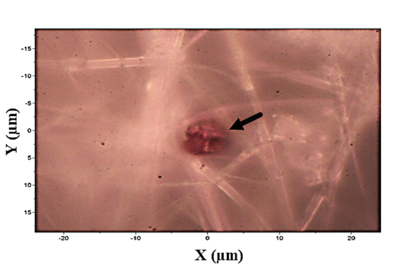 image of a plastic particle in a placenta