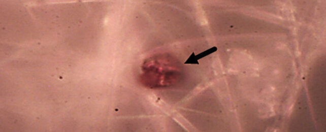 Alarming Increase in Microplastics Detected in Human Placentas