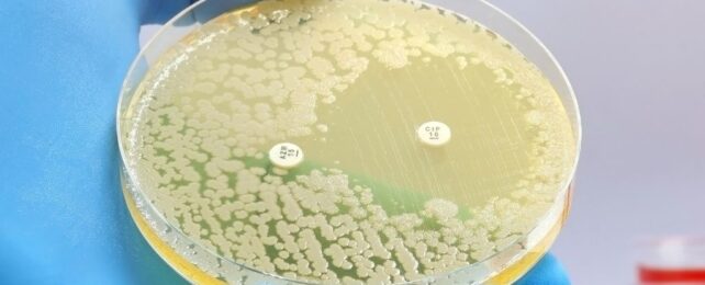 Blobs of bacteria on yellow agar plate, steering clear of one but not the other antibiotic laced white dot