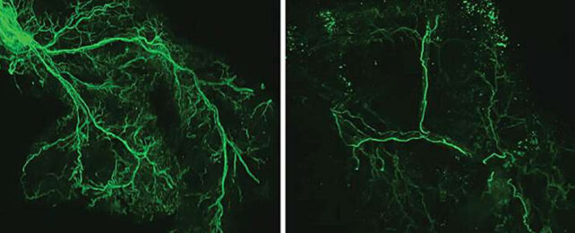 Lines of green glowing nerves branching densely on the left but sparsely on the right.