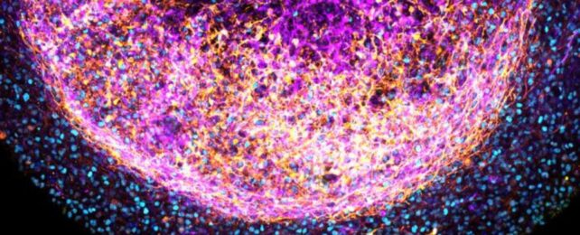 This 'Mini-Brain' Is Made From Real Tissue - And It Has Huge Potential