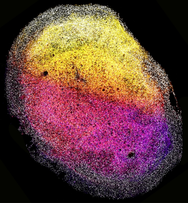 An image of a whole human fetal brain organoid