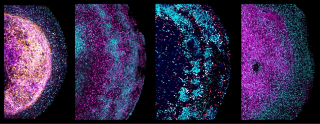 Four zoom-in images of parts of different human fetal brain organoids