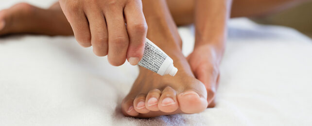women putting topical treatment on her toe