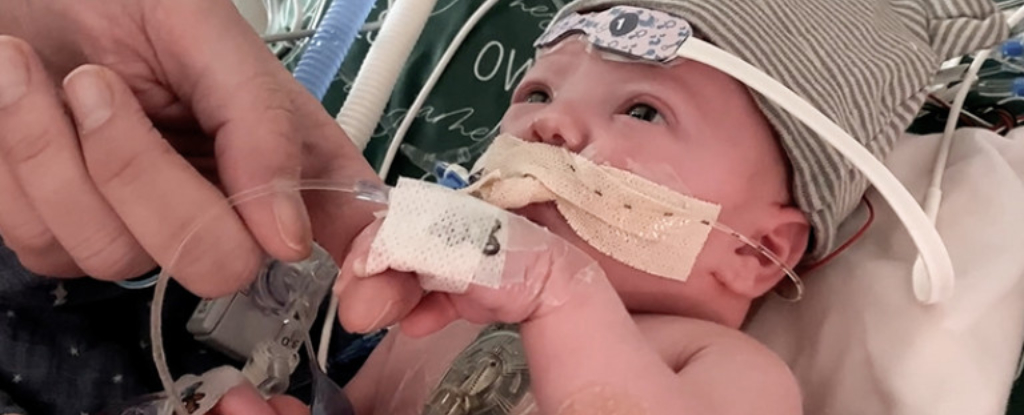 El primer trasplante parcial de corazón del mundo está creciendo con un bebé: Heaven32