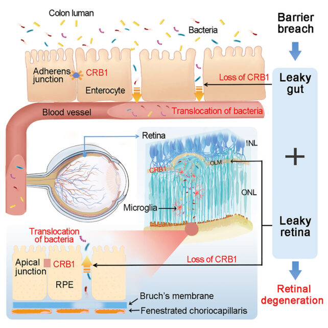 A graphic depicting the process 