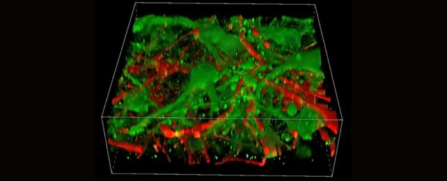 layers of brain tissue in green and red