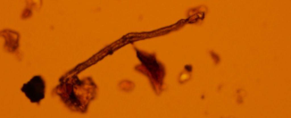 Microplásticos encontrados en cada placenta humana analizada, según un estudio: Heaven32