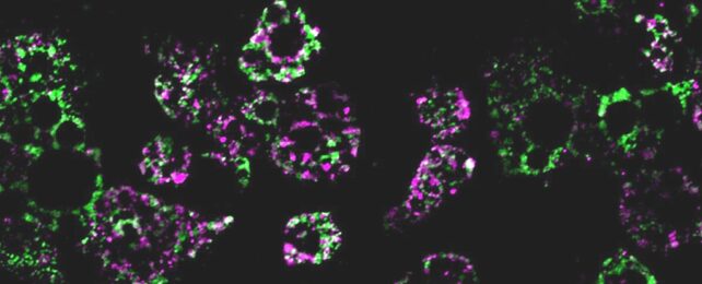 Mitochondrial Networks