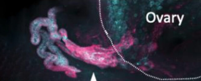 Magenta fleurescent tissue markers highlighting the external part of the rete ovaraii