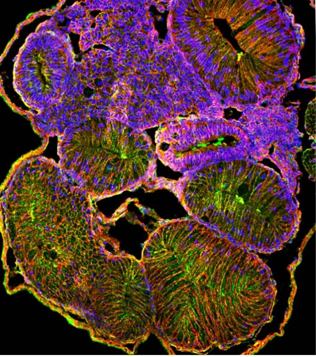 Intestine transverse section labeled in purple and green