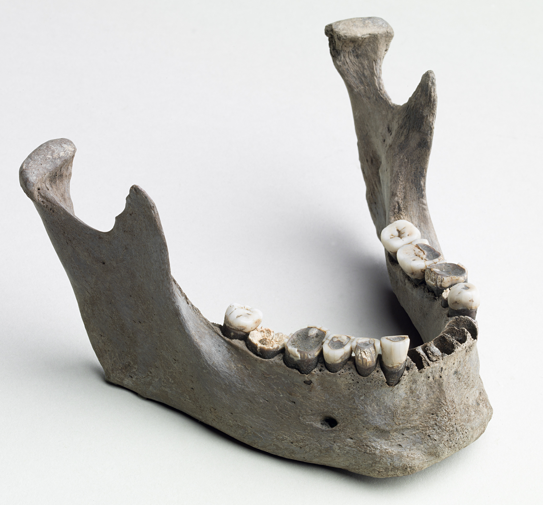 an entire human jawbone, with most teeth intact, showing signs of wear on the crown. at least 4 teeth at the front are missing. specimen photographed on seamless white background