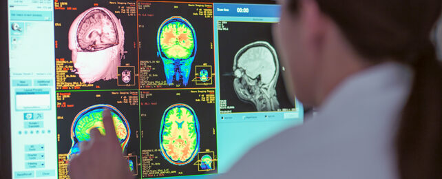 woman looking at a computer screen with brain scans displayed