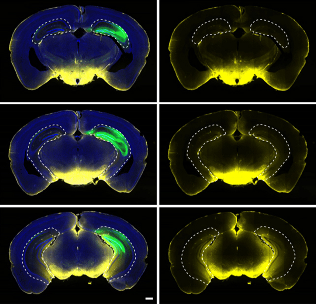 Mouse brain waves