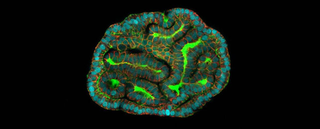 Kidney organoid