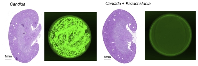 two purple kidneys and two green circles